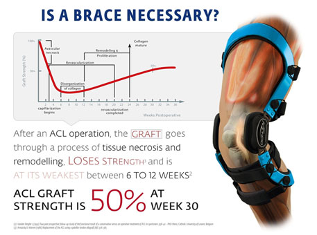 knee brace info