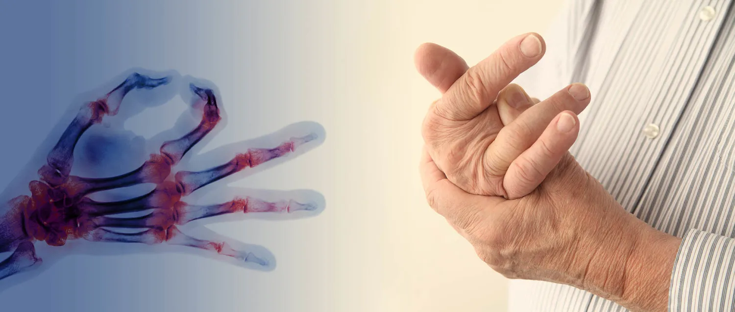 arthritis pain management specialist