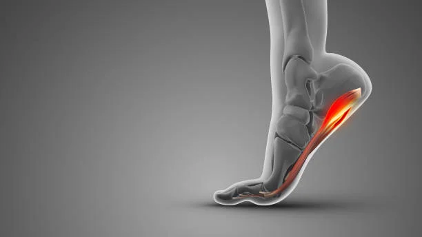 orthotics for plantar fasciitis